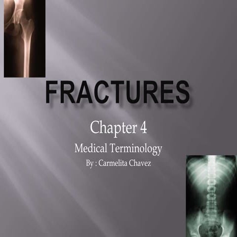 Fractures
