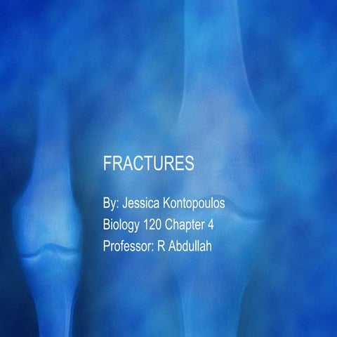 FRACTURE (TYPES AND PATTERN) | PPTX