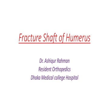 Fracture shaft of humerus