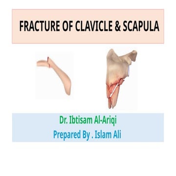 The Fractures of clavicle & scapula.pptx