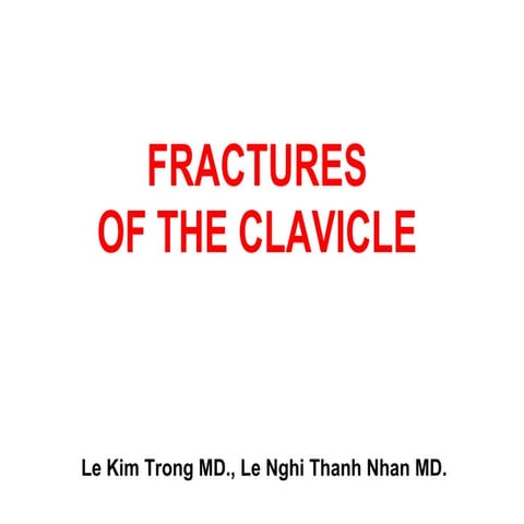 Fractures of the clavicle