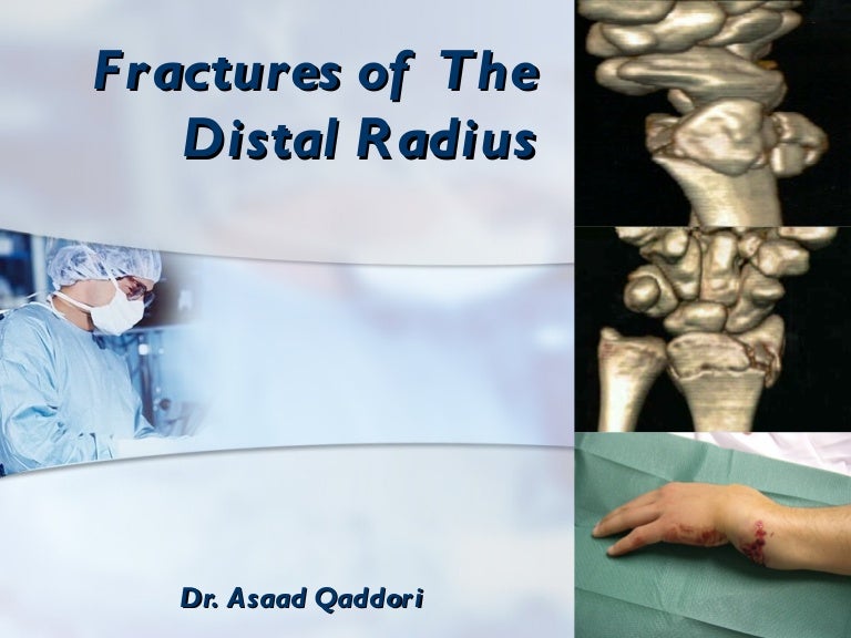 Fractures Of The Distal Radius