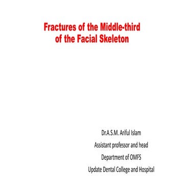 Fractures of the Middle-third of the Facial Skeleton (1).pptx