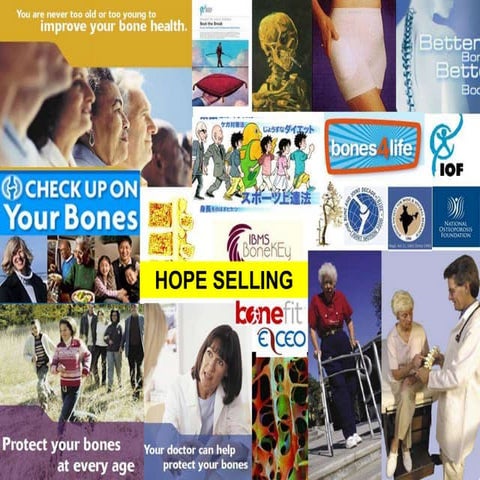 osteoporotic Fragility fractures treatment