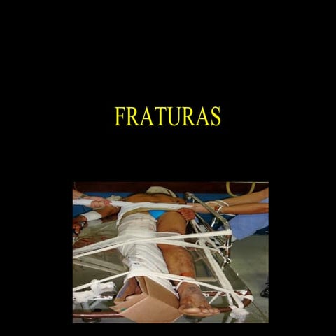 Fraturas
