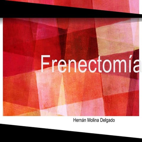 Frenectomía hernan molina