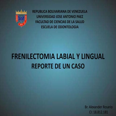 Frenilectomia Labial y Lingual. Reporte de un Caso