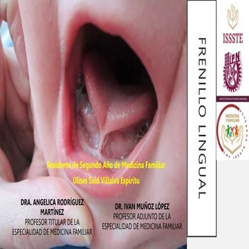 Frenillo lingual.pptx