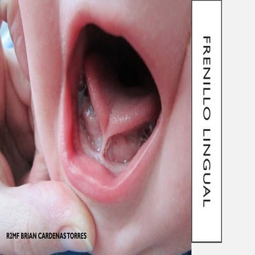FRENILLO LINGUAL CLASE DE ORL RESIDENCIA MF.pptx