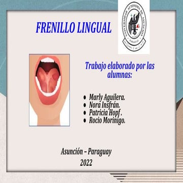 Frenillo lingual corto.pptx