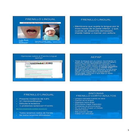 Frenillo lingual