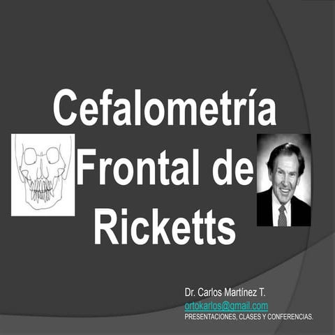 Cierre de Espacios en Ortodoncia | PPTX