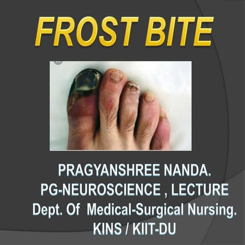 Frost bite