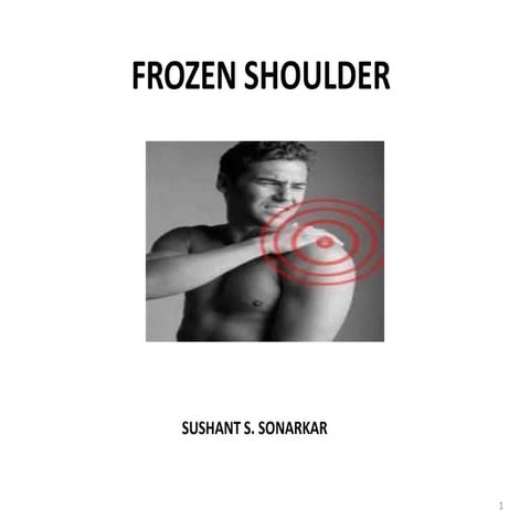Frozen shoulder ADHESIVE CAPSULITIS OF SHOULDER