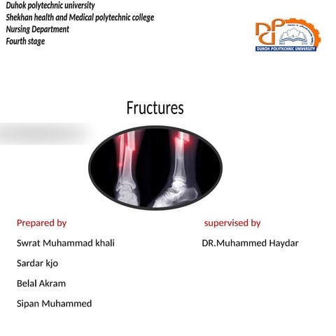 fructures.pptx...........................