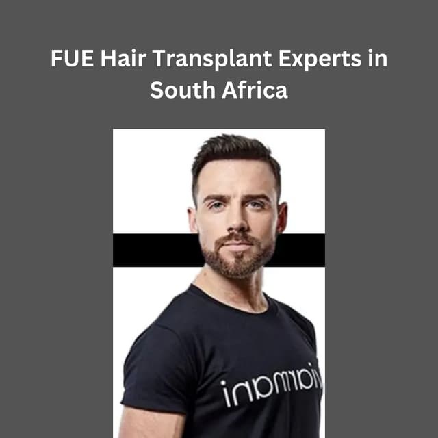 FUE Hair Transplant Experts in South Africa.pdf