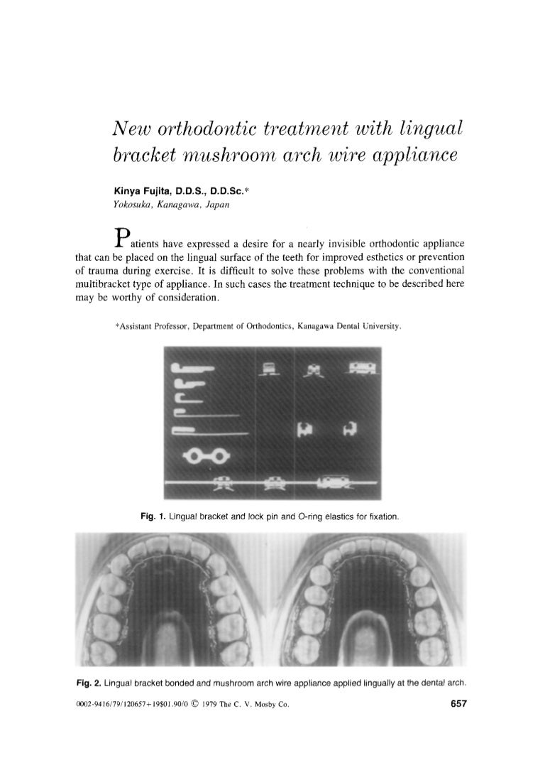 Fujita lingual orthodontics ajo article