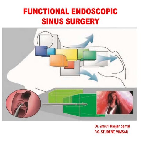 Functional endoscopic sinus surgery