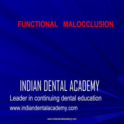 Functional malocclusion   /certified fixed orthodontic courses by Indian dent...