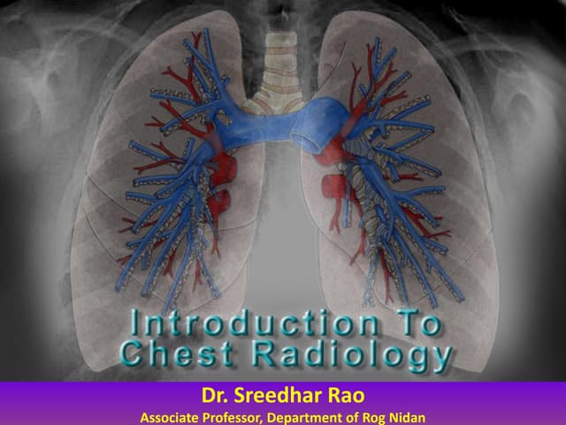 Fundamentals of chest radiology