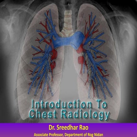 Fundamentals of chest radiology