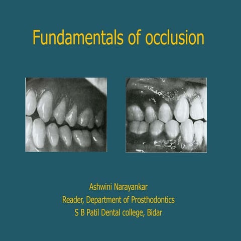 fundamentals of occlusion.pptx