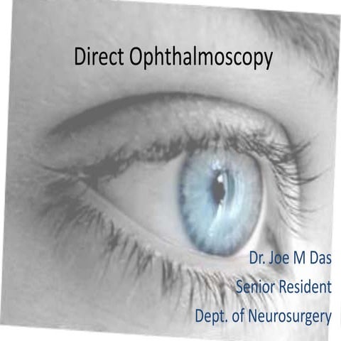 fundoscopy-140202111417-phpapp02.pdf