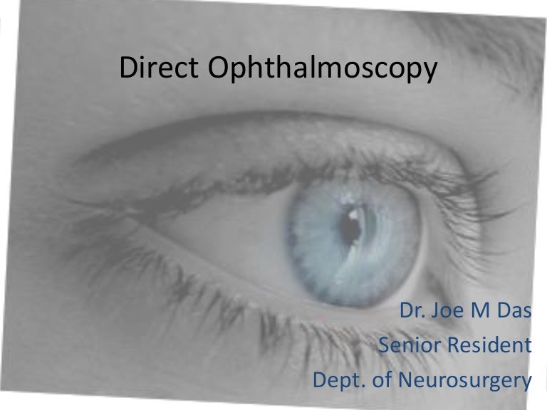 Direct Ophthalmoscopy