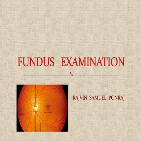 Fundus examination
