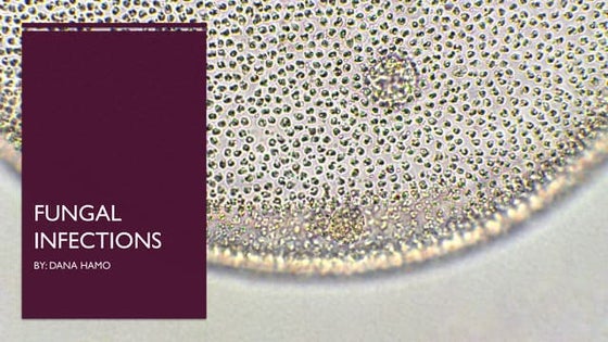 superficial fungal infections.pptx