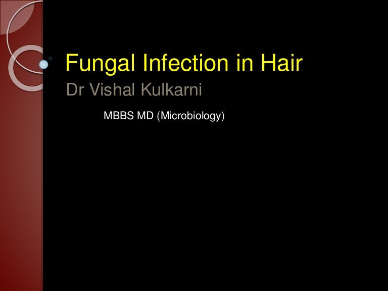 Fungal Infection In Hair