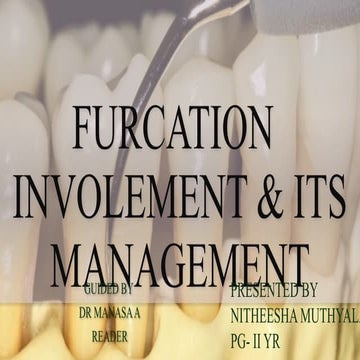 FURCATION involvement & management  presented by nitheesha muthyala
