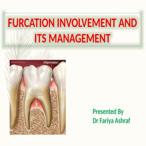 Furcation involvement and management | PPTX