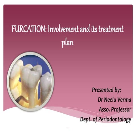 FURCATION and its classification 1 .pptx
