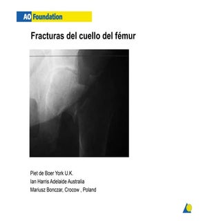 Fx cuello femur