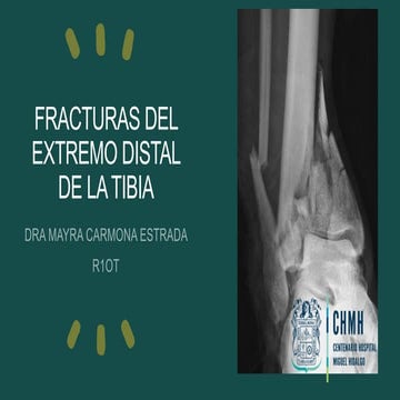 FX TIBIA METAFISIARIA DISTAL DE TIBIA.pptx