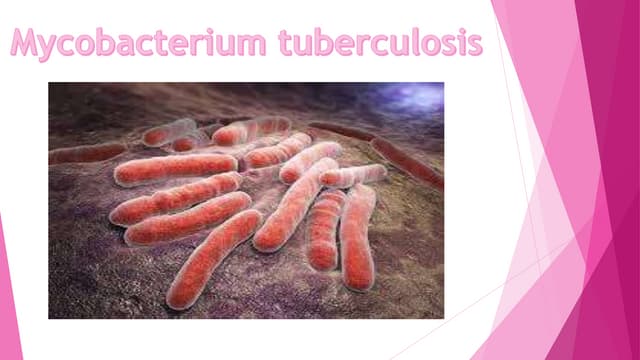 Tuberculosis (TB).