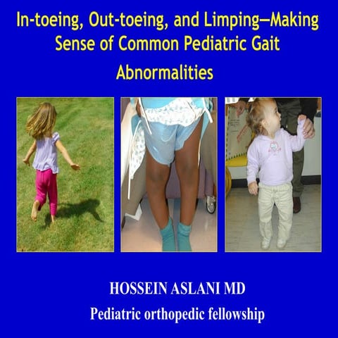 gaitabnormalitiesinchildren-22121509.ppt