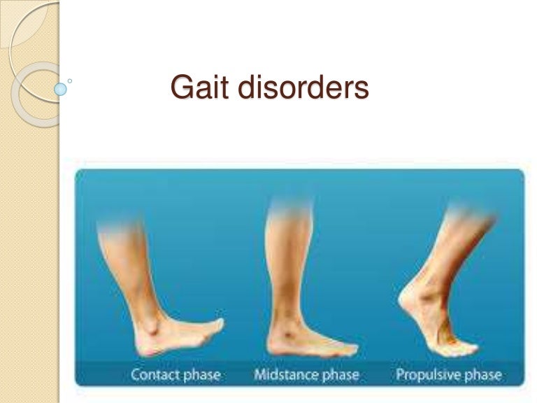 Gait disorders