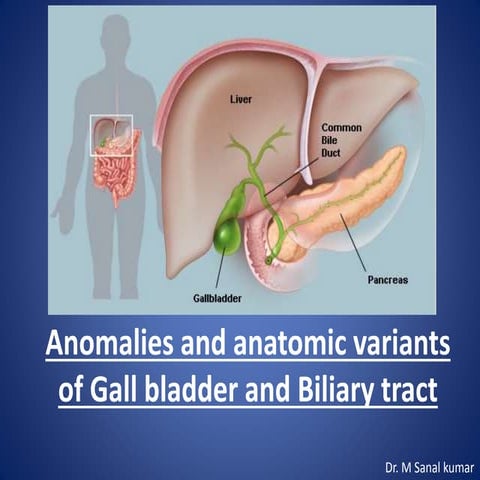 Gall bladder & biliary tract  anomalies and variants