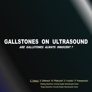 Gallstones on Ultrasound - Are Gall...