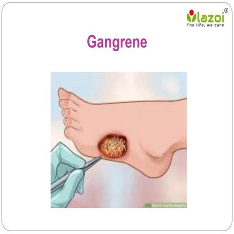 Gangrene