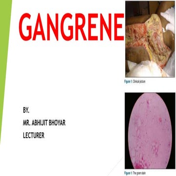 Gangrene
