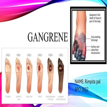 gangrenepresentation.pptx for healthcare