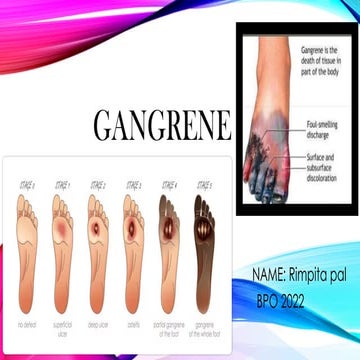 gangrenepresentationpatholgyimpbpoa.pptx