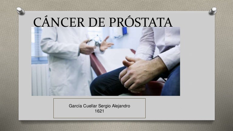 ¿Con qué frecuencia recibe radioterapia para el cáncer de próstata?