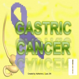 Gastric Cancer PPT