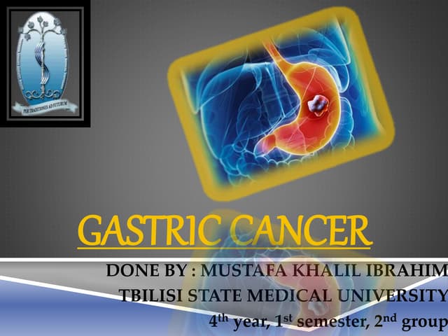 Gastric Cancer ( stomach tumor )