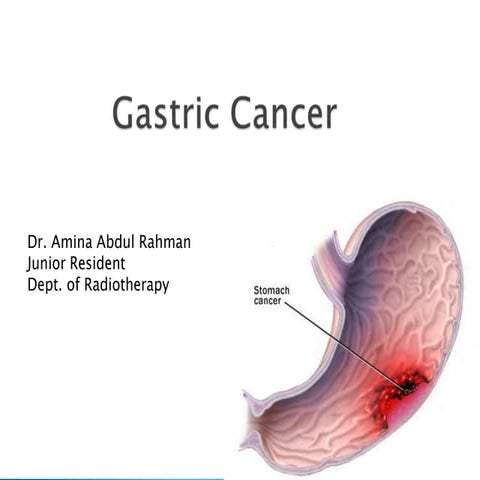 Gastric cancer, investigations and management