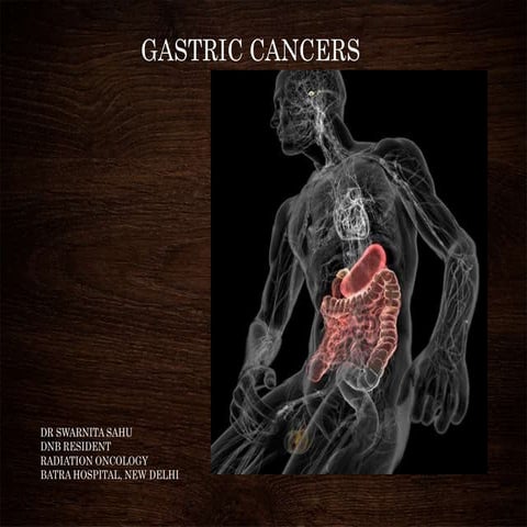 Gastric cancers